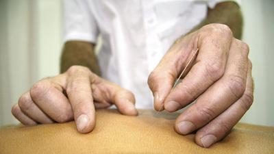 Acupuncture is thought to ease pain by raising the level of endorphins (natural pain relievers) in the body